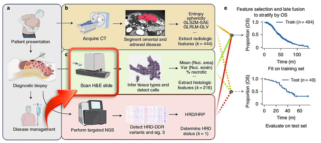 麦克奥迪EasyScan扫描仪助力全球顶级癌症中心突破卵巢癌多模态诊断壁垒