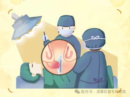 痔疮手术后，要躺几天？