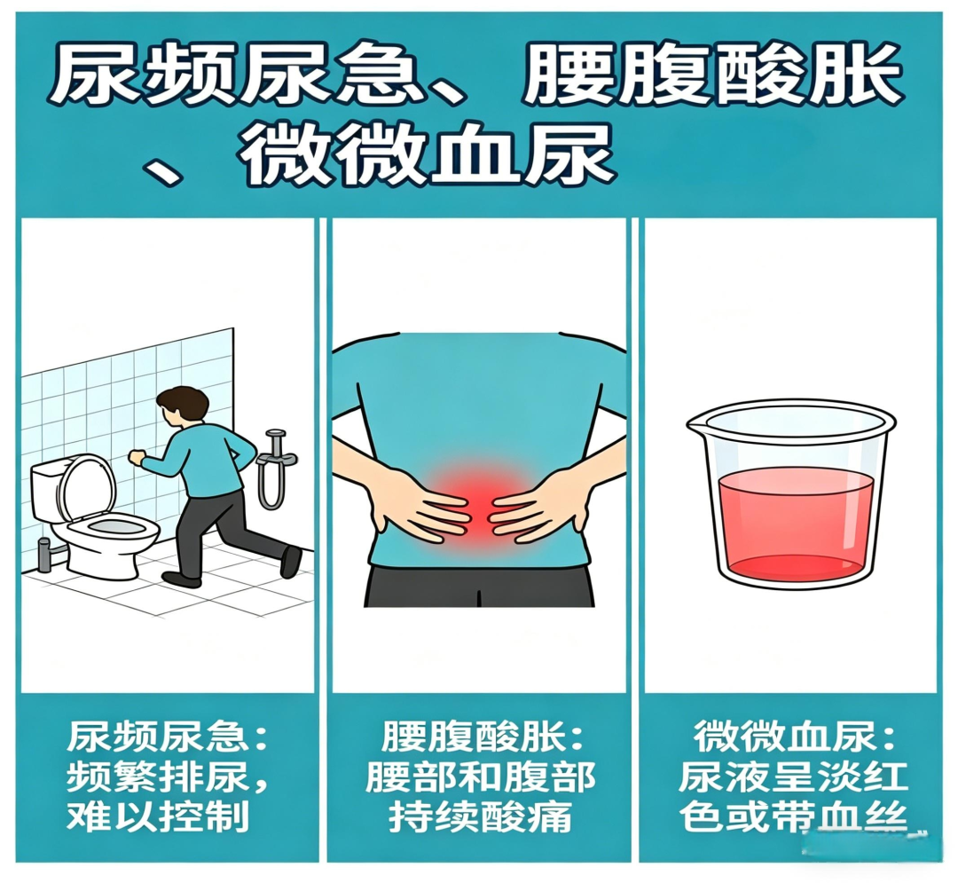 猪输尿管怎么吃【健康科普】结石术后留置的 “猪尾巴管”：不是负担，是肾脏的 “保护符”_https://www.jmylbn.com_新闻资讯_第6张