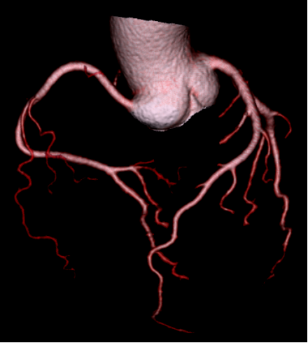 联影有哪些CT医疗服务 ｜ 我院放射科引入联影uCT 960+高端CT设备，开启精准影像诊疗新篇章_https://www.jmylbn.com_新闻资讯_第6张