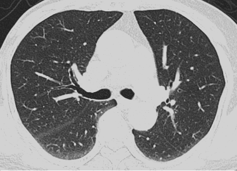 联影有哪些CT医疗服务 ｜ 我院放射科引入联影uCT 960+高端CT设备，开启精准影像诊疗新篇章_https://www.jmylbn.com_新闻资讯_第2张