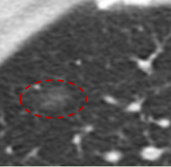 联影有哪些CT医疗服务 ｜ 我院放射科引入联影uCT 960+高端CT设备，开启精准影像诊疗新篇章_https://www.jmylbn.com_新闻资讯_第11张
