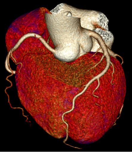 联影有哪些CT医疗服务 ｜ 我院放射科引入联影uCT 960+高端CT设备，开启精准影像诊疗新篇章_https://www.jmylbn.com_新闻资讯_第5张