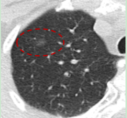 联影有哪些CT医疗服务 ｜ 我院放射科引入联影uCT 960+高端CT设备，开启精准影像诊疗新篇章_https://www.jmylbn.com_新闻资讯_第10张