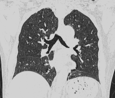 联影有哪些CT医疗服务 ｜ 我院放射科引入联影uCT 960+高端CT设备，开启精准影像诊疗新篇章_https://www.jmylbn.com_新闻资讯_第3张