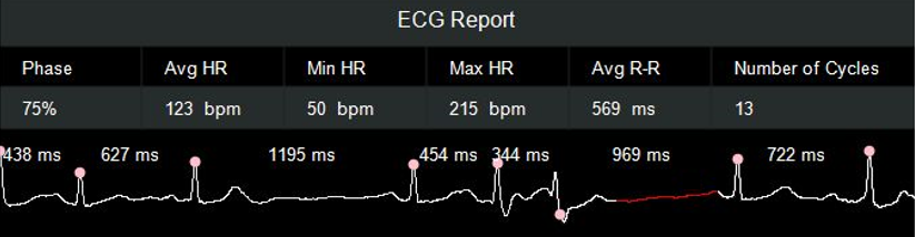 联影有哪些CT医疗服务 ｜ 我院放射科引入联影uCT 960+高端CT设备，开启精准影像诊疗新篇章_https://www.jmylbn.com_新闻资讯_第7张