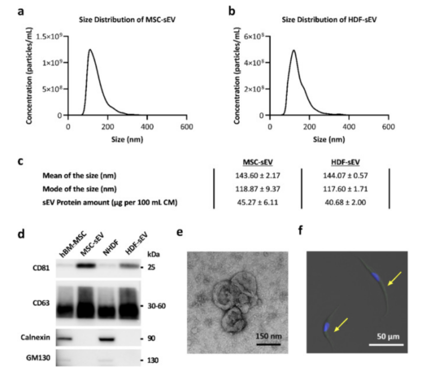 研究案例｜揭秘 EVs 研究背后的共同“神器”！