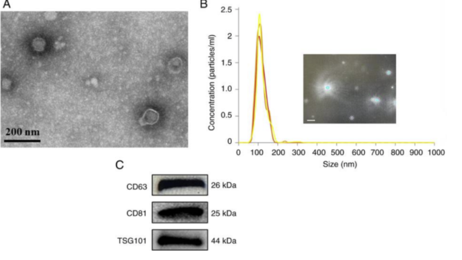 研究案例｜揭秘 EVs 研究背后的共同“神器”！