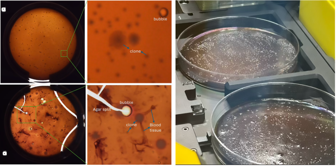 當(dāng)“腸道菌群”遇上自動(dòng)化：QPix FLEX 如何加速厭氧微生物篩選？