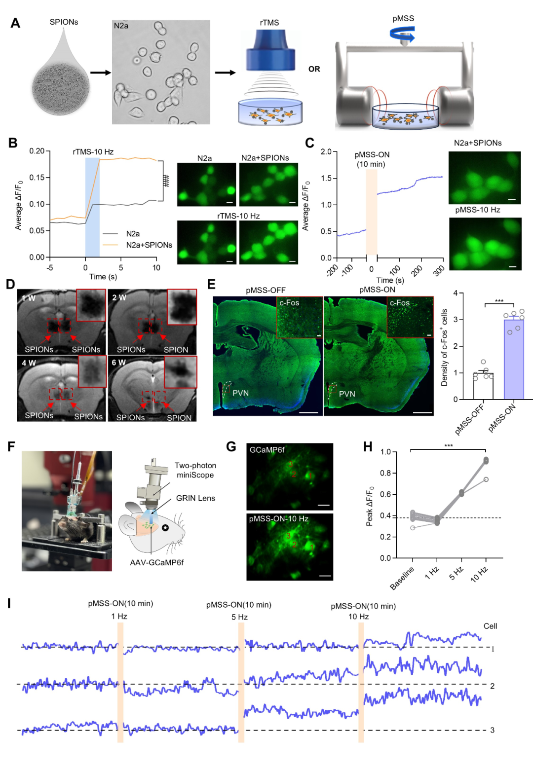 微型化雙光子技術(shù)助力發(fā)現(xiàn)精確磁刺激室旁核可改善孤獨癥小鼠的社交能力