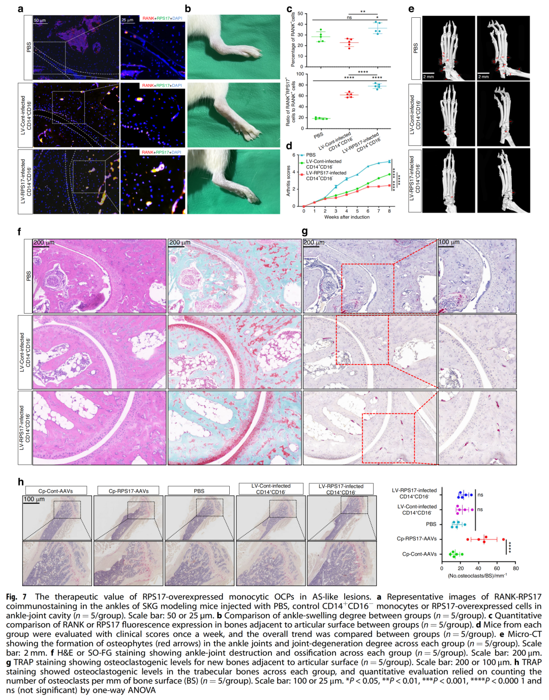 人外周破骨細胞前體發育模式