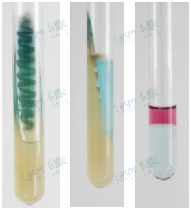 绿脓色素试验（+）