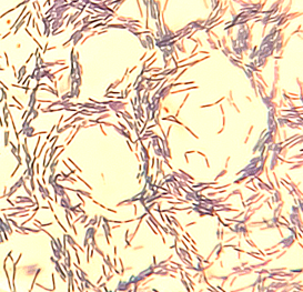 革兰氏阳性杆状，很少成链，染色均匀，内生孢子，游离孢子着色弱