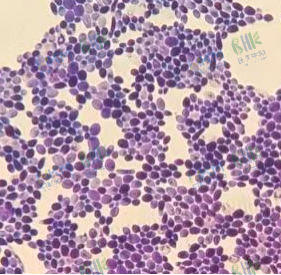 呈卵圆形，很象酵母菌，比葡萄球菌大5～6倍，革兰氏染色阳性，但着色不均匀