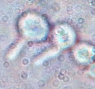 挑取1%吐温80-玉米琼脂培养基上的培养物，接种于加有一滴血清的载玻片上，盖上盖玻片，置湿润的平皿内，置 35～37°、1～3 小时，置显微镜下观察，可见到由孢子长出短小芽管