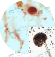 菌丝壁厚而光滑。顶部形成球形顶囊，状如“菊花“，其上全面覆盖一层梗基和一层小梗，小梗上长有成串褐黑色的球状，分生孢子头球状，褐黑色