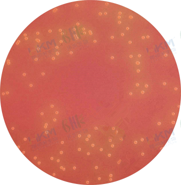 黄色圆形凸起中等大小菌落，菌落形态一致