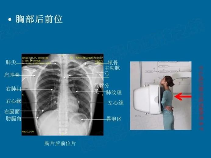 dr数字怎么用【西计科普】＂数字画家＂—— 解密DR技术_https://www.jmylbn.com_新闻资讯_第14张