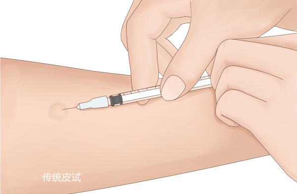 无痛皮试怎么做做皮试还在扎针？NO！NO！NO！我们用一块“手表”就OK啦_https://www.jmylbn.com_新闻资讯_第10张