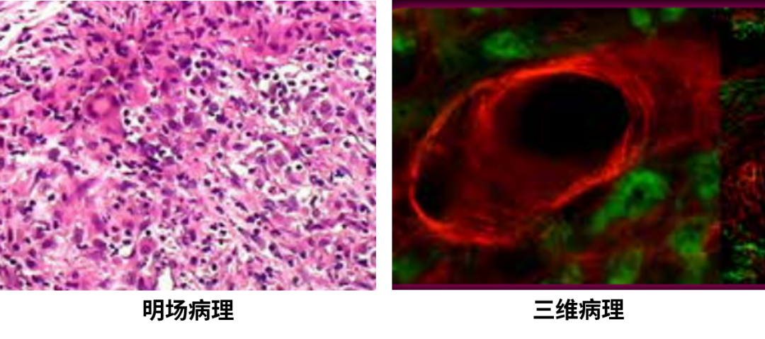 应用推荐 | JAI高速三线线阵相机，让病理切片扫描更快、更准、更真实