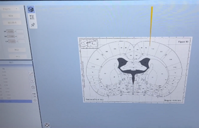 兰格注射泵在脑立体定位仪中的应用方案