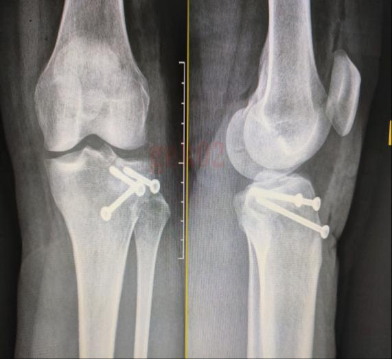 医学影像dr是什么DR、CT怎么选？一篇帮你搞懂！_https://www.jmylbn.com_新闻资讯_第7张
