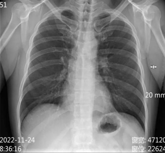 医学影像dr是什么DR、CT怎么选？一篇帮你搞懂！_https://www.jmylbn.com_新闻资讯_第5张
