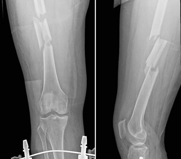 医学影像dr是什么DR、CT怎么选？一篇帮你搞懂！_https://www.jmylbn.com_新闻资讯_第8张