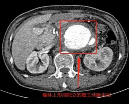 医学影像dr是什么DR、CT怎么选？一篇帮你搞懂！_https://www.jmylbn.com_新闻资讯_第12张