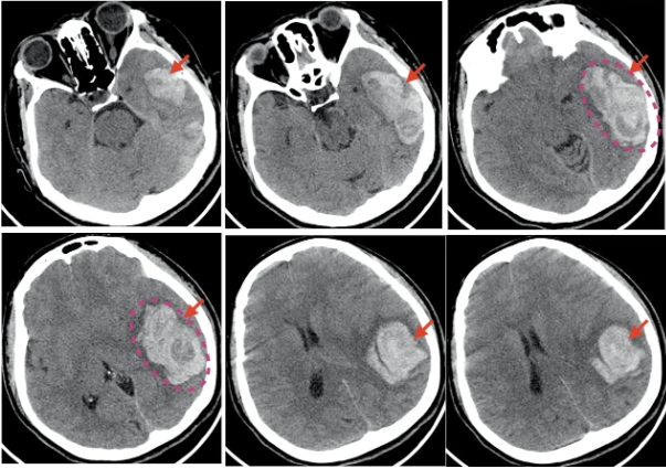 医学影像dr是什么DR、CT怎么选？一篇帮你搞懂！_https://www.jmylbn.com_新闻资讯_第10张