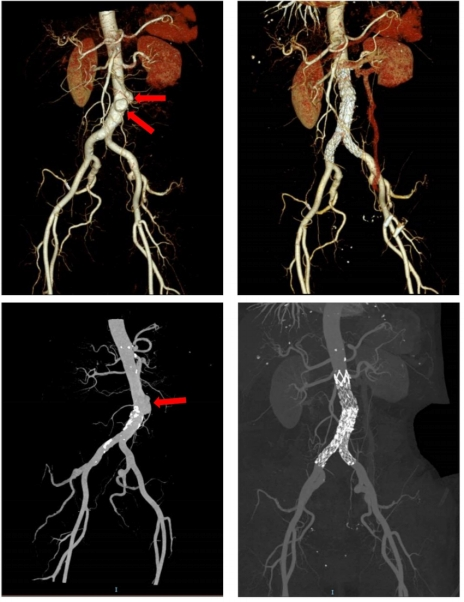 医学影像dr是什么DR、CT怎么选？一篇帮你搞懂！_https://www.jmylbn.com_新闻资讯_第11张
