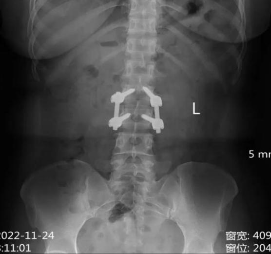 医学影像dr是什么DR、CT怎么选？一篇帮你搞懂！_https://www.jmylbn.com_新闻资讯_第6张