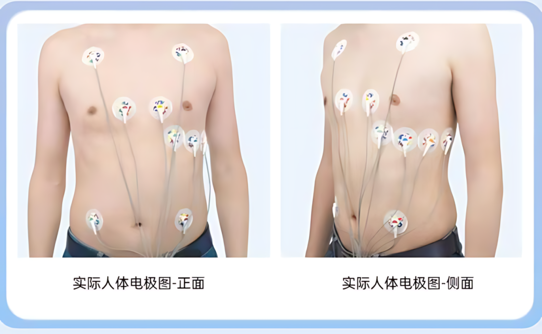 动态心电图系统怎么用【康达健康科普】动态心电图 — 心脏的24小时“贴身保镖”！_https://www.jmylbn.com_新闻资讯_第11张