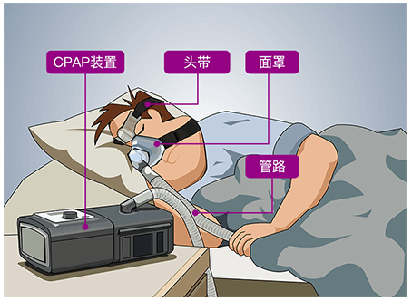 使用呼吸机憋气怎么办【健康科普】别再误解呼吸机！它不只是“重症专属”，还能解决这些呼吸烦恼_https://www.jmylbn.com_新闻资讯_第14张