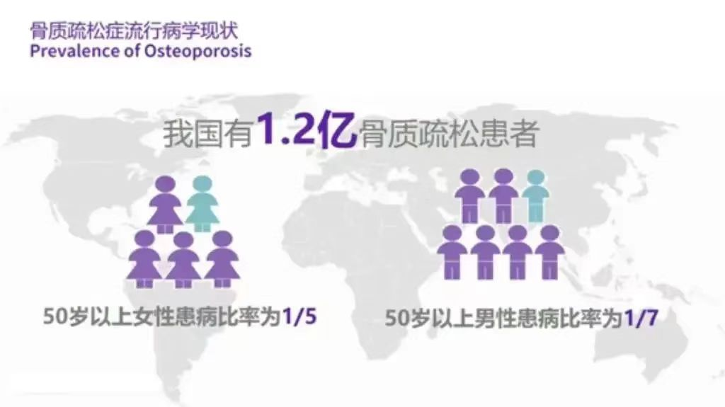 双能x骨密度检测仪为什么非得输入体重身高骨密度测量的“金标准”——双能X线骨密度仪_https://www.jmylbn.com_新闻资讯_第2张