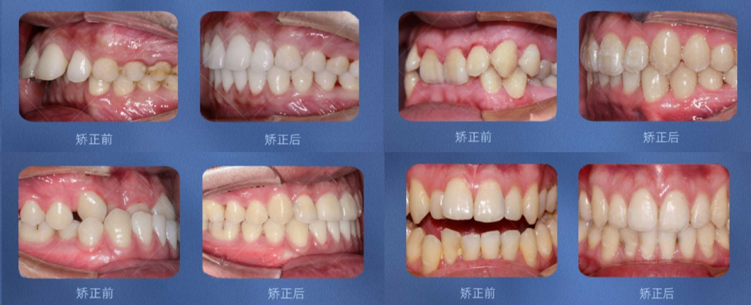 慈恩名人堂 | 林慧：巾帼正畸翘楚，匠心笑颜先锋