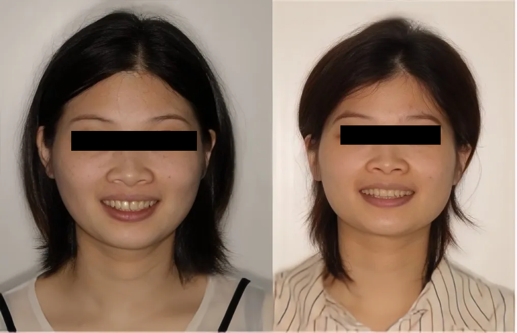 慈恩名人堂 | 盛广：正畸艺术才俊，仁心仁术之师