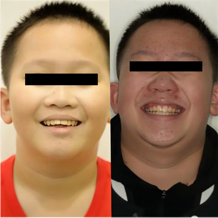 慈恩名人堂 | 盛广：正畸艺术才俊，仁心仁术之师