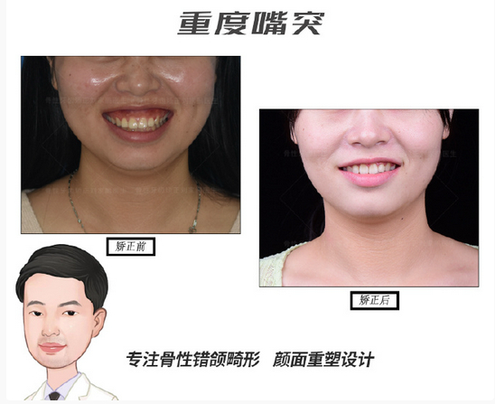 深圳唯一！“慈恩双咖”同台受邀献讲，闪耀「2026时代天使“春茗” 精品班」