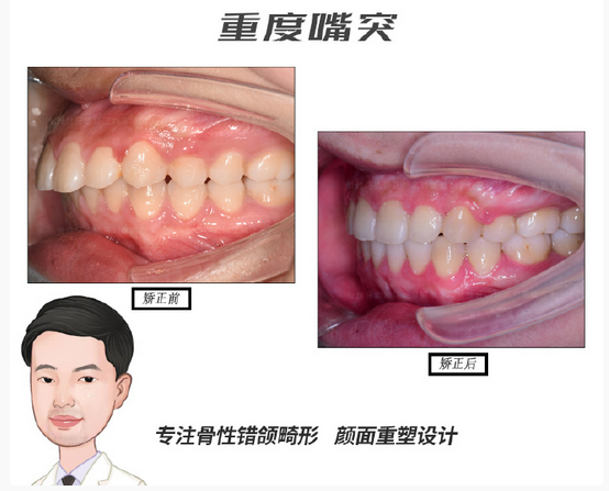 深圳唯一！“慈恩双咖”同台受邀献讲，闪耀「2026时代天使“春茗” 精品班」