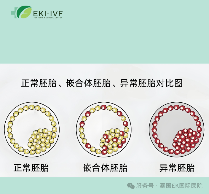 泰国试管EKI-IVF高龄三代试管应该怎么做