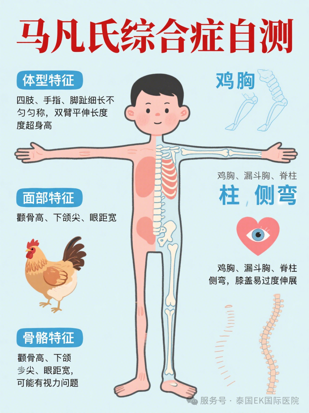结缔组织病——马凡综合征患者如何生育健康宝宝？泰国三代试管技术EKI-IVF