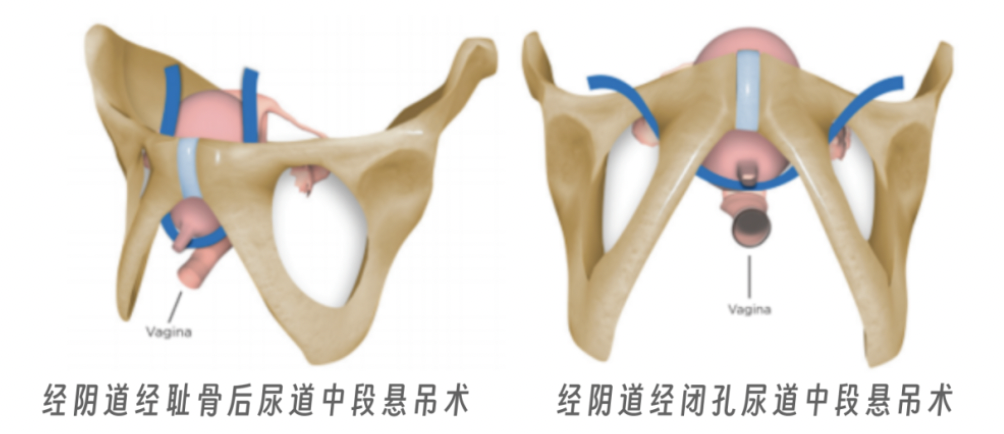 截屏2026-04-15 16.08.36.png