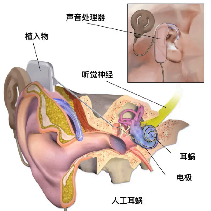 1-260Q2195301194.png