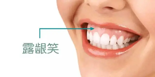 图片2.png