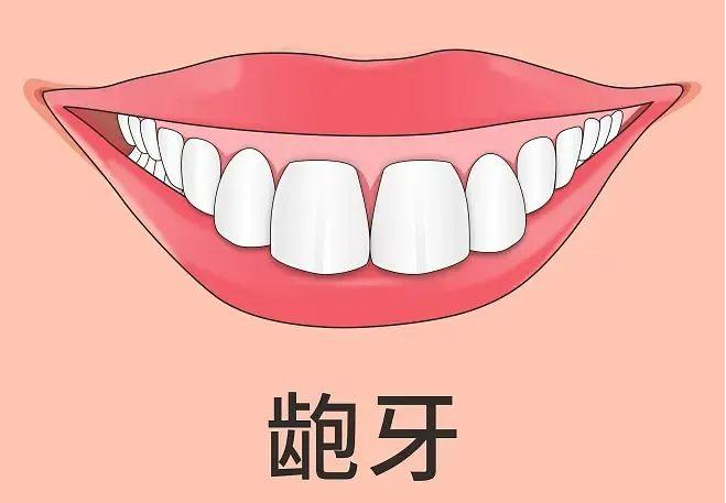 图片1(1).png