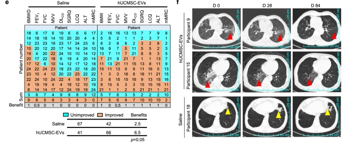 Nebulized Exosomes Significantly Improve Pulmonary Fibrosis
