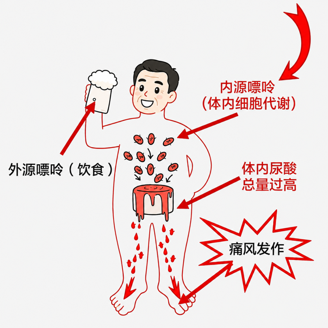痛风总反复？可能不是你忌口不够