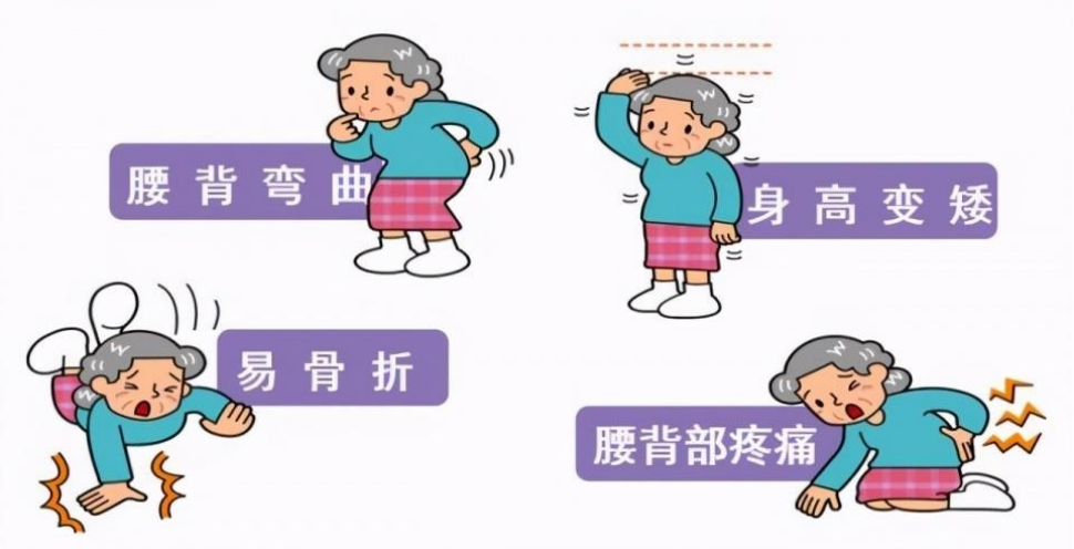 双能x骨密度检测仪为什么非得输入体重身高骨骼健康的侦察兵-双能X线骨密度仪_https://www.jmylbn.com_新闻资讯_第1张