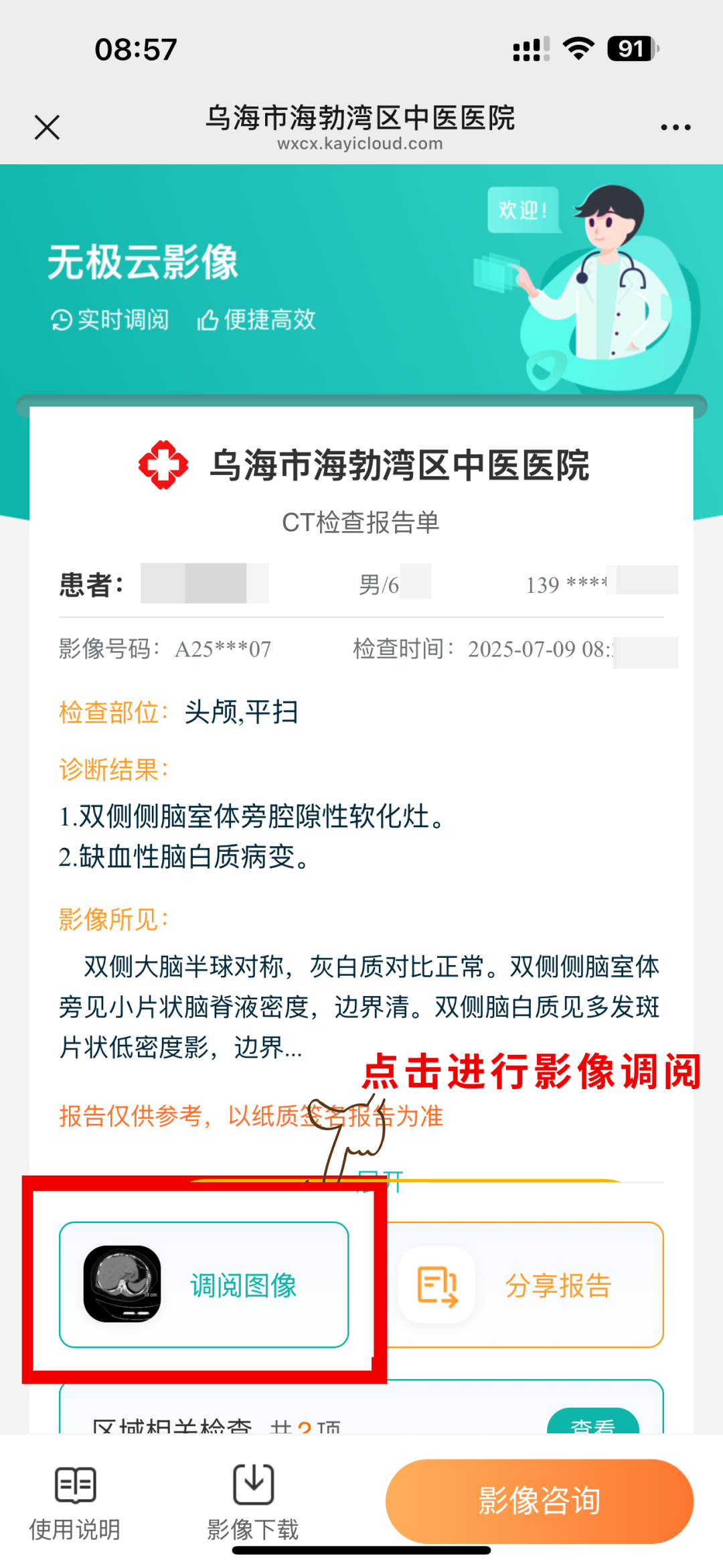 放射科怎么打印海勃湾区中医医院电子胶片获取流程来啦！_https://www.jmylbn.com_新闻资讯_第7张